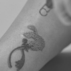 Eliminación Tattoo